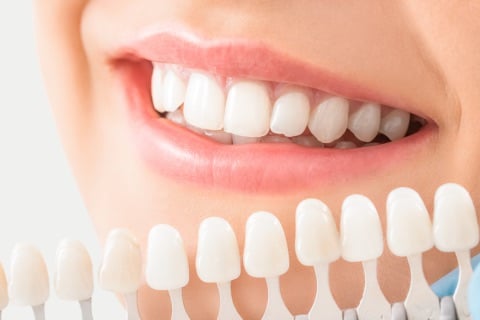 Composite Bonding