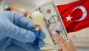Cost of Dental Implants in Turkey