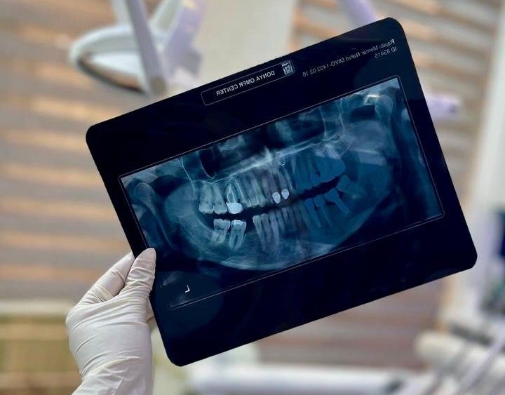 Dental X-rays