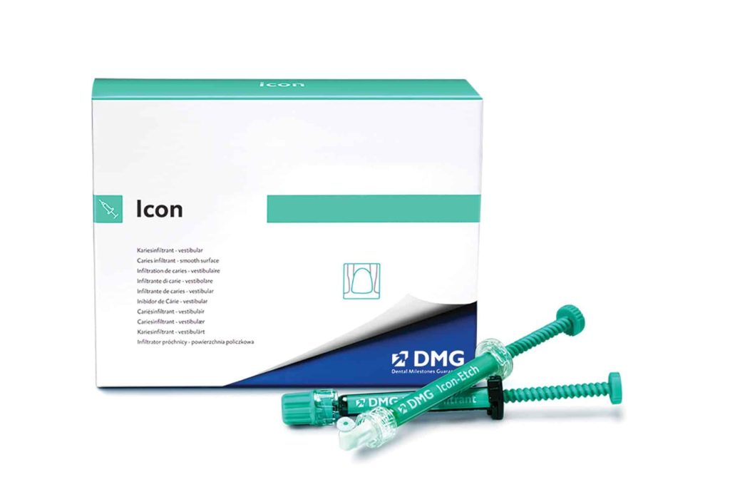 ICON Resin Infiltration