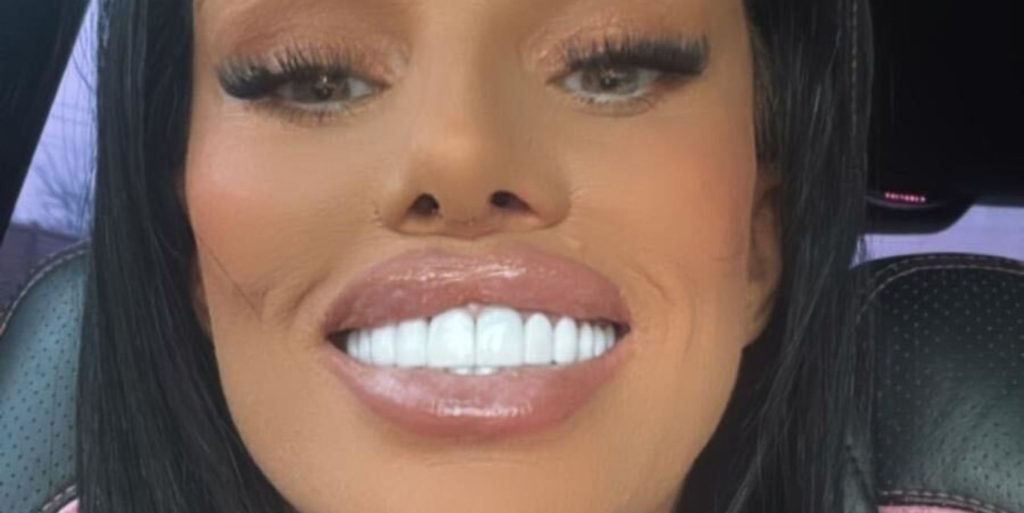 Katie Price teeth 2025