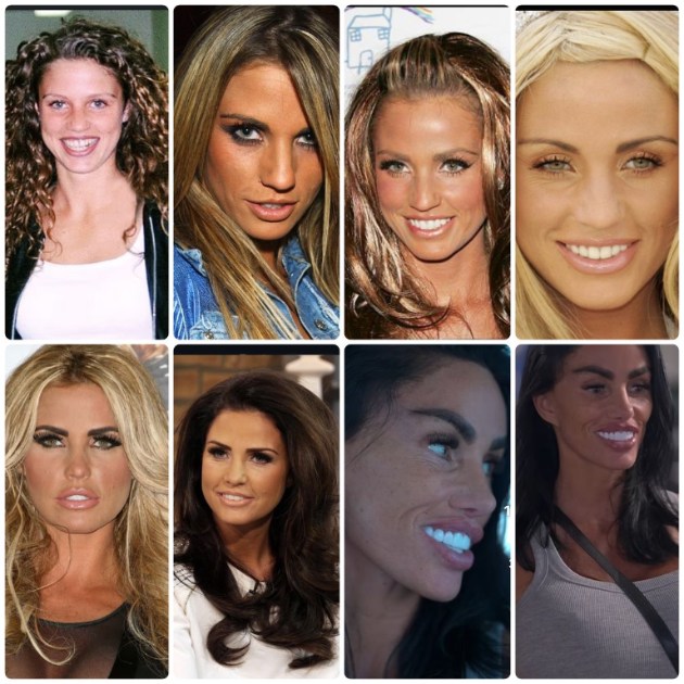 Katie Price’s dental transformation