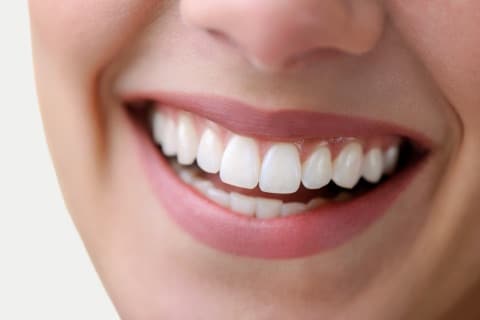 Smile Makeover