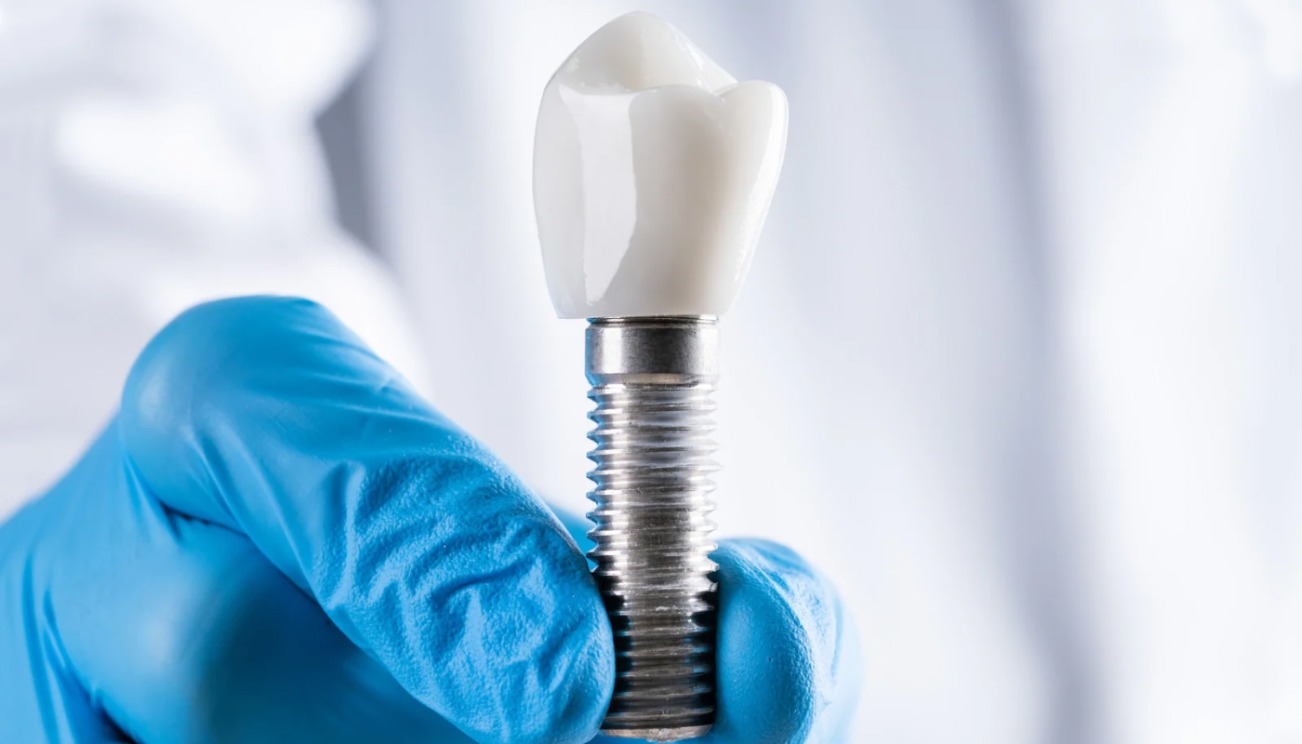 Turkey Teeth Implant Guide Prices, Recovery & Before After