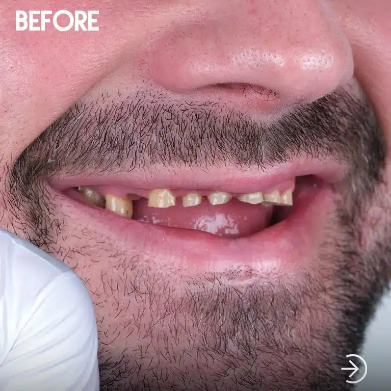 VK Smile Studio before after