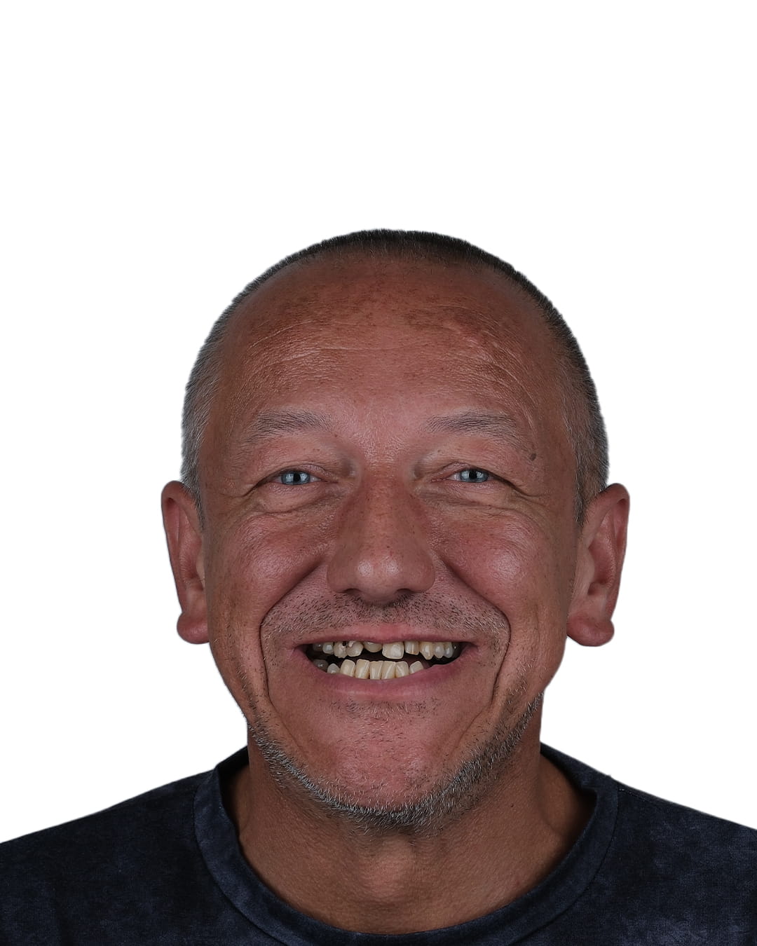 VK Smile Studio before after photo