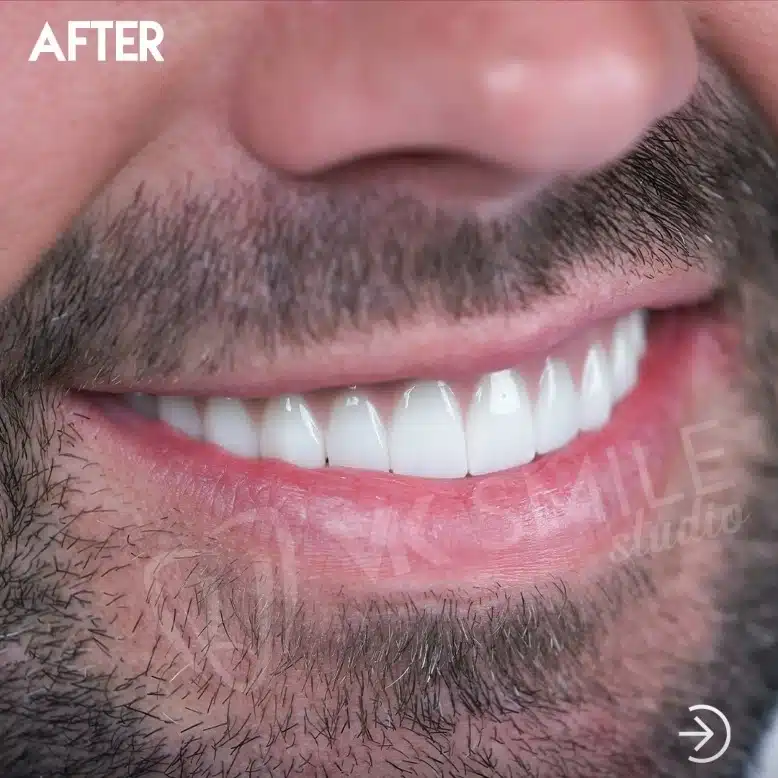 VK Smile Studio before after