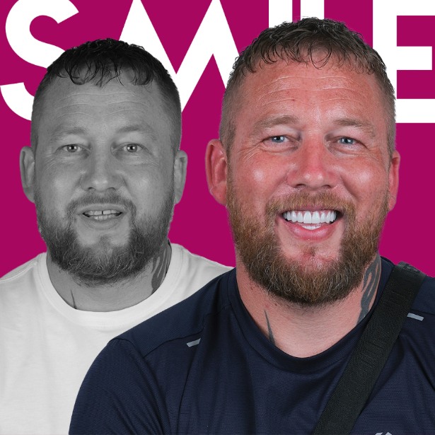 Zahnbrücken in der Türkei