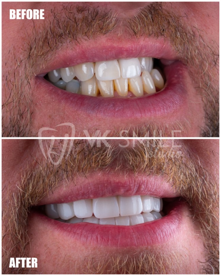 VK Smile Studio before after