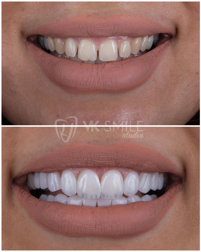 VK Smile Studio Dental Centre in Turkey