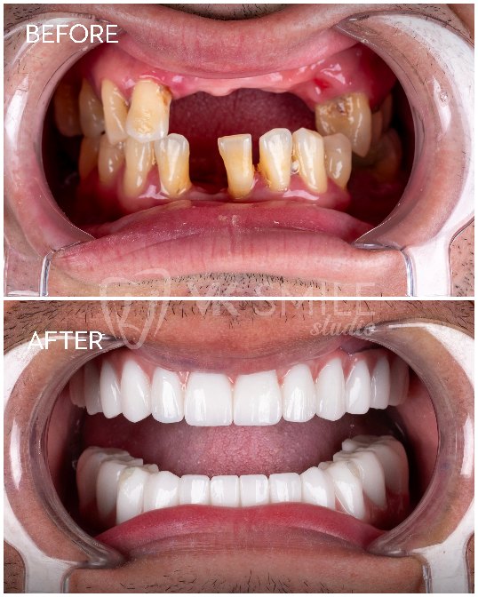 VK Smile Studio before after