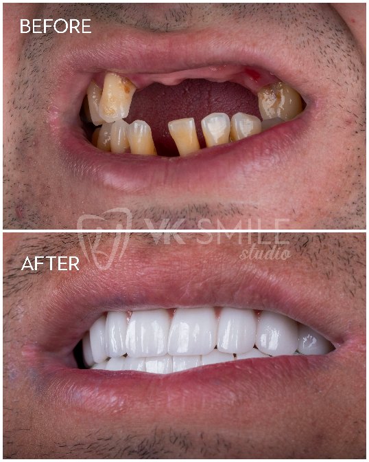 VK Smile Studio before after