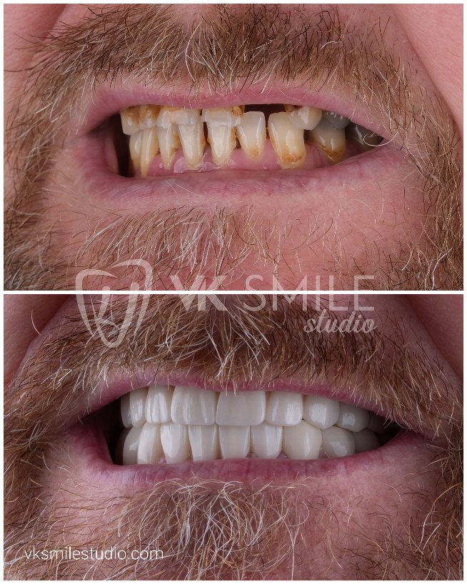 VK Smile Studio before after