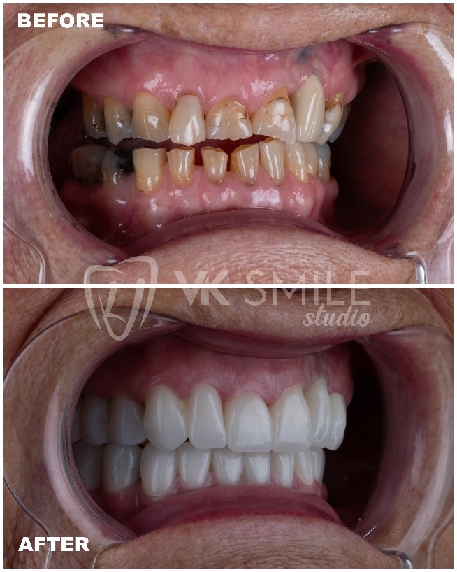 VK Smile Studio before after