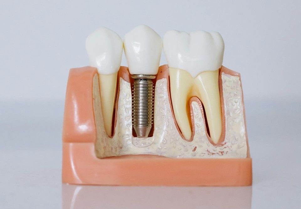 What is bone density?