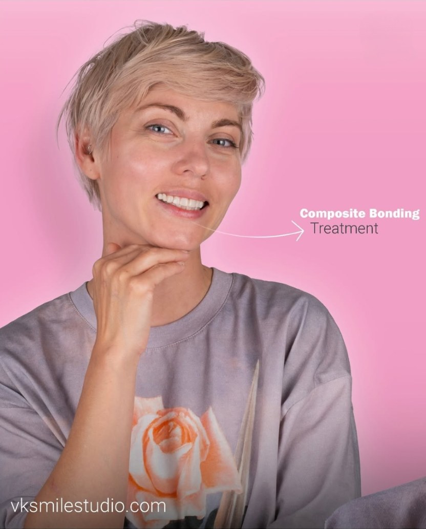 Composite bonding treatment in Turkey result