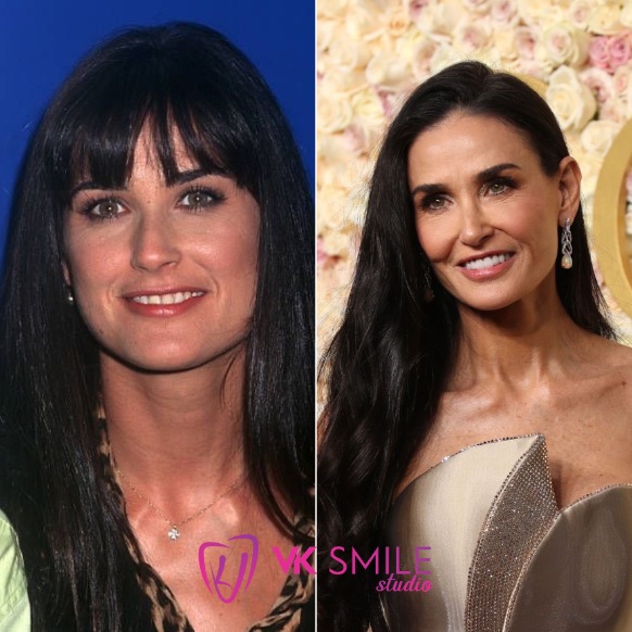 Demi Moore teeth