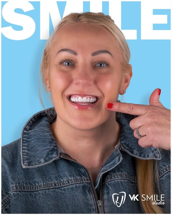 Dental veneers in Turkey