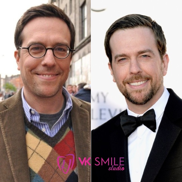 Ed Helms teeth