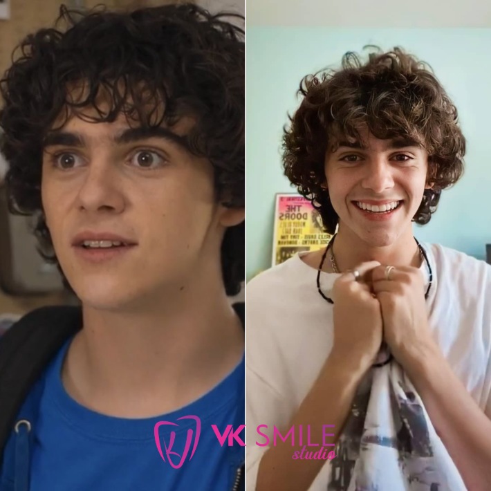 Freddie Freeman teeth