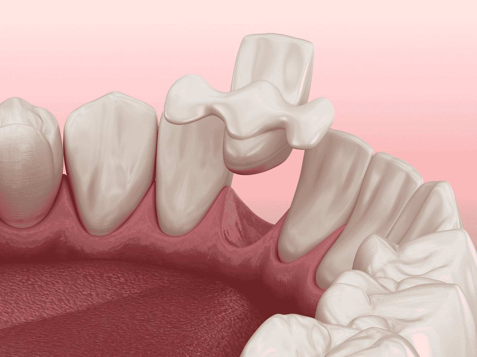 Maryland-Verbundbrücke