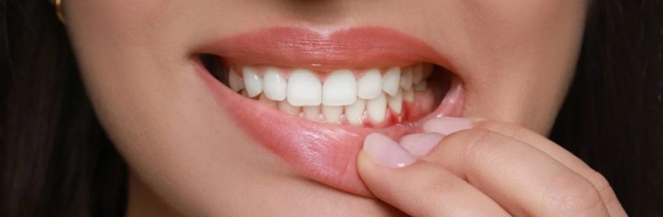 Restorative Dentistry Meaning