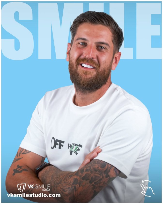 Dental veneers before&after