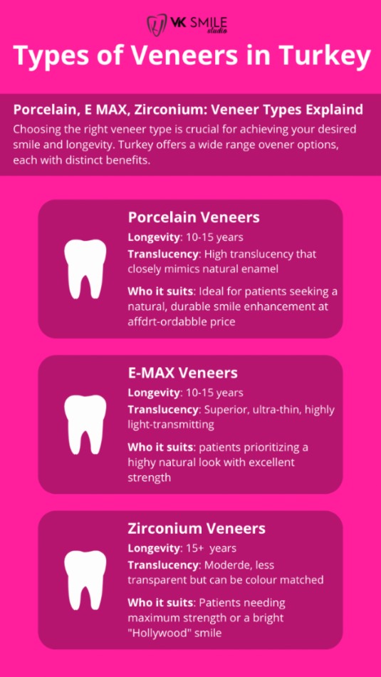 Veneers types